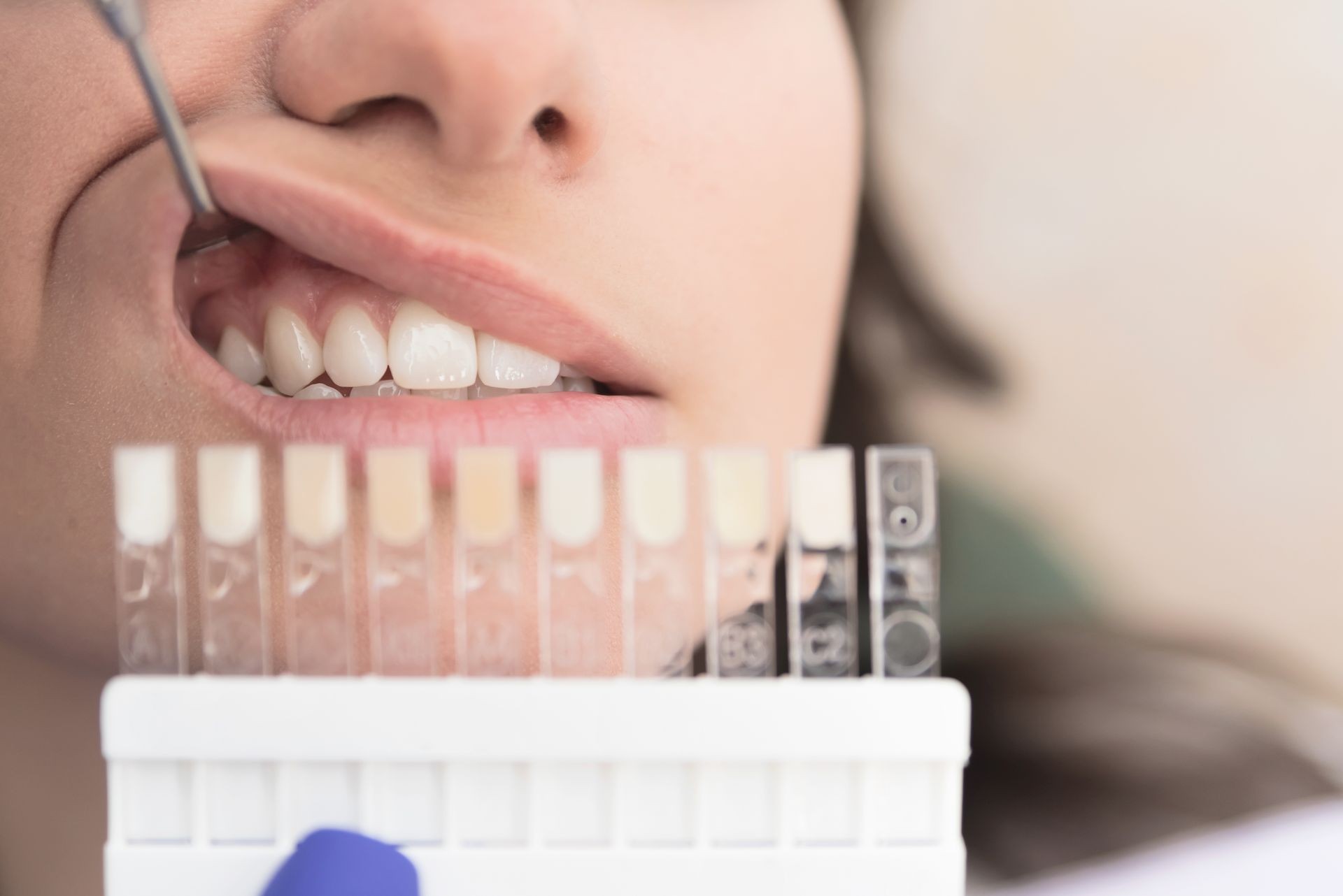 Closeup cropped image of female patient at dental clinic having her teeth checked for whitening, Comparing teeth colour with template