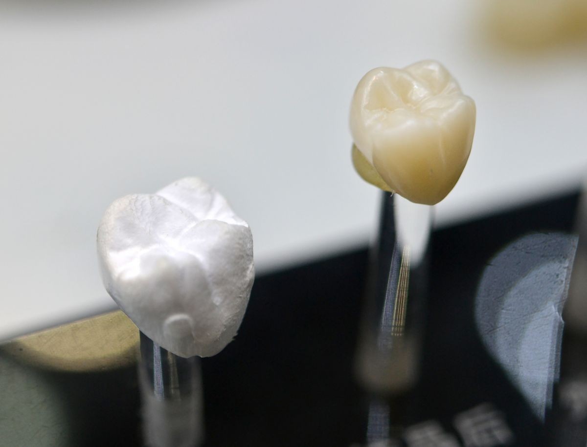 several models artificial human dental crown close-up